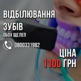 Відбілювання зубів ВСЬОГО 1100 грн. +Поверхнева чистка БЕЗКОШТОВНО. обох... Оголошення Bazarok.ua