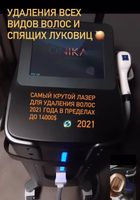 Продаем аппараты по лазерным технологиям и косметологии... Оголошення Bazarok.ua