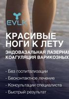 Лечение варикозного расширения вен - ЭВЛК, Харьков... Оголошення Bazarok.ua
