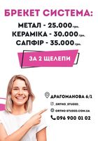 АКЦІЙНА ПРОПОЗИЦІЯ НА БРЕКЕТ-СИСТЕМУ... Оголошення Bazarok.ua